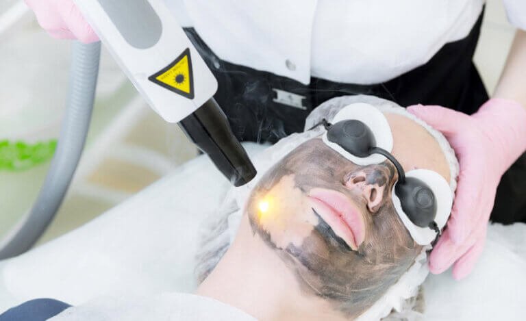 "Hollywood Facial "