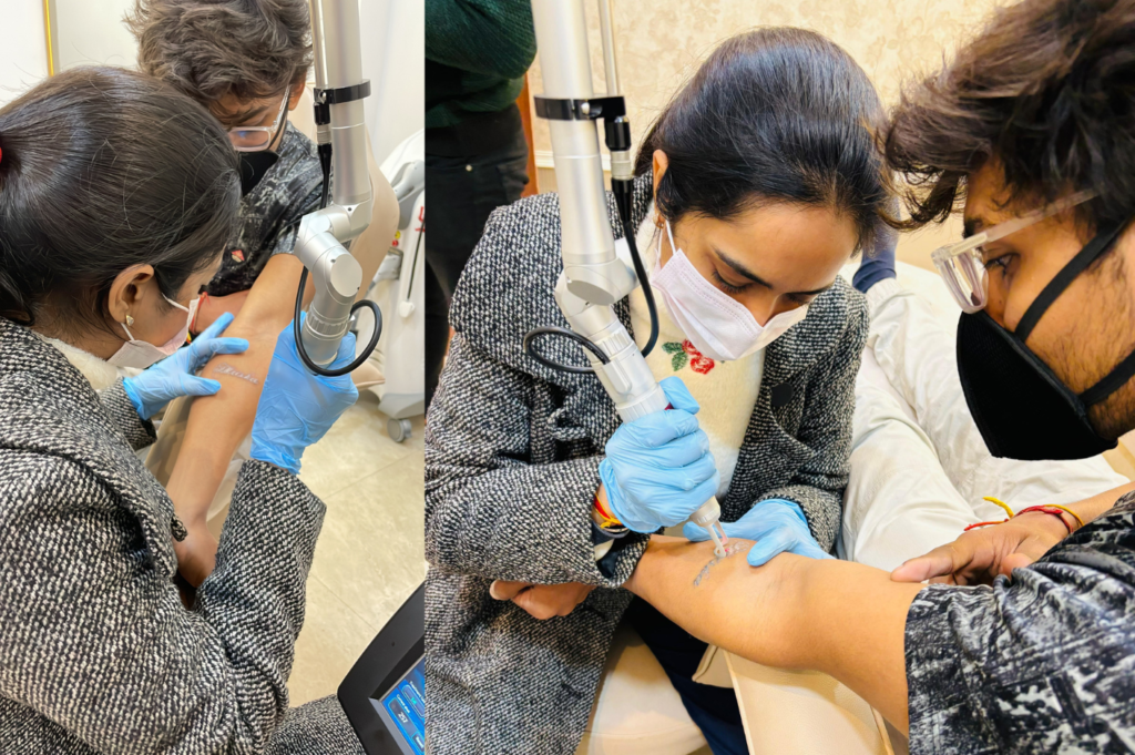 Tattoo Removal