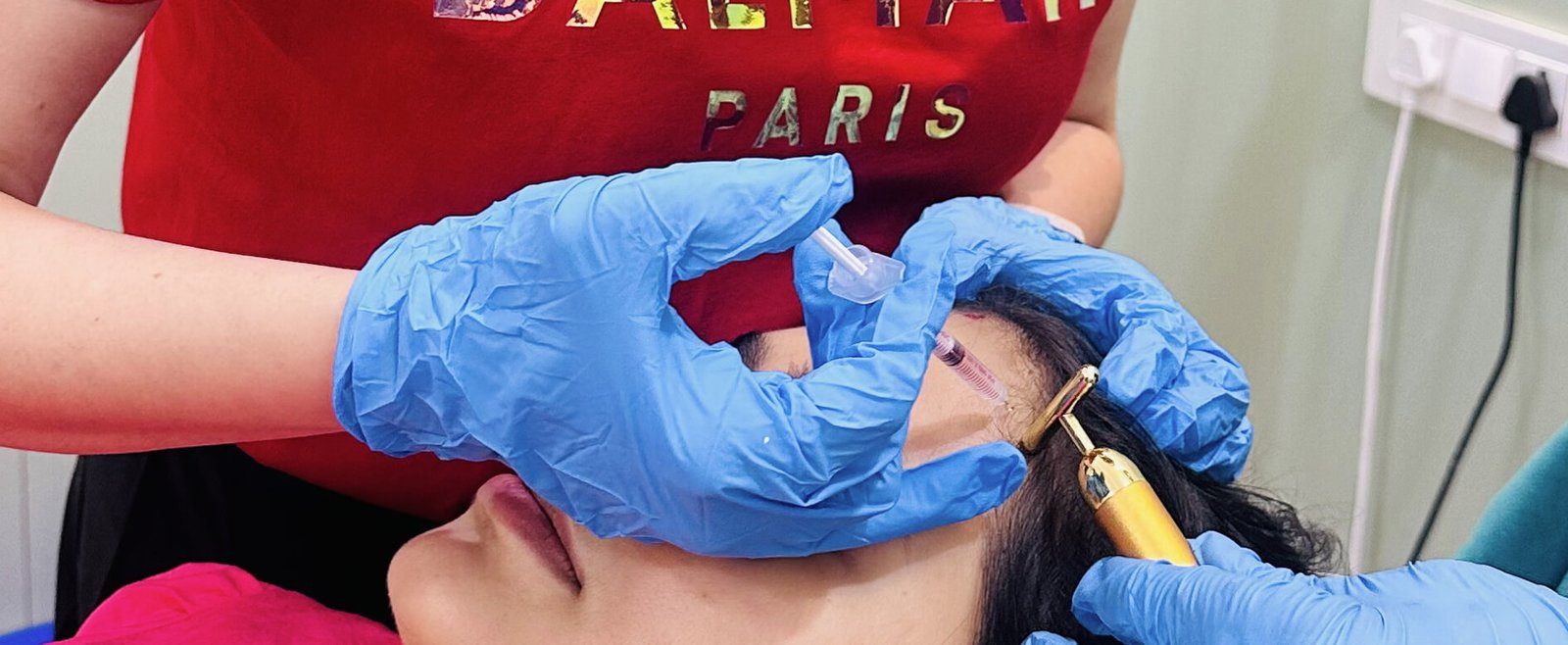 prp therapy