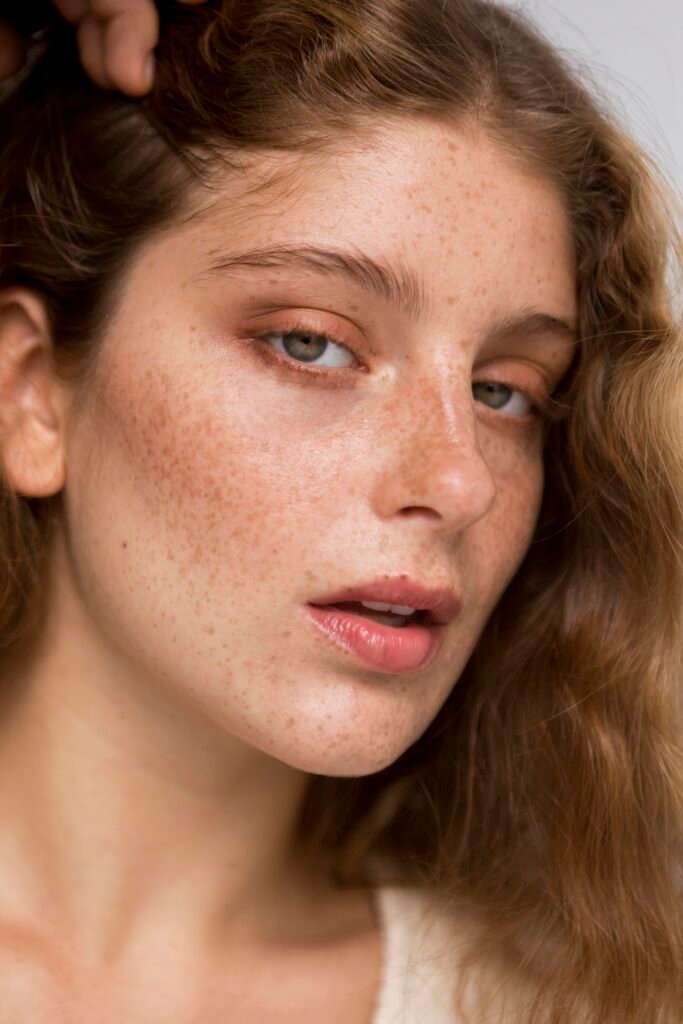 Best Skin Pigmentation Treatment in Faridabad