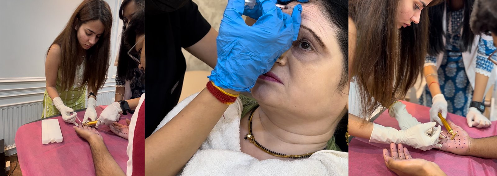 botox