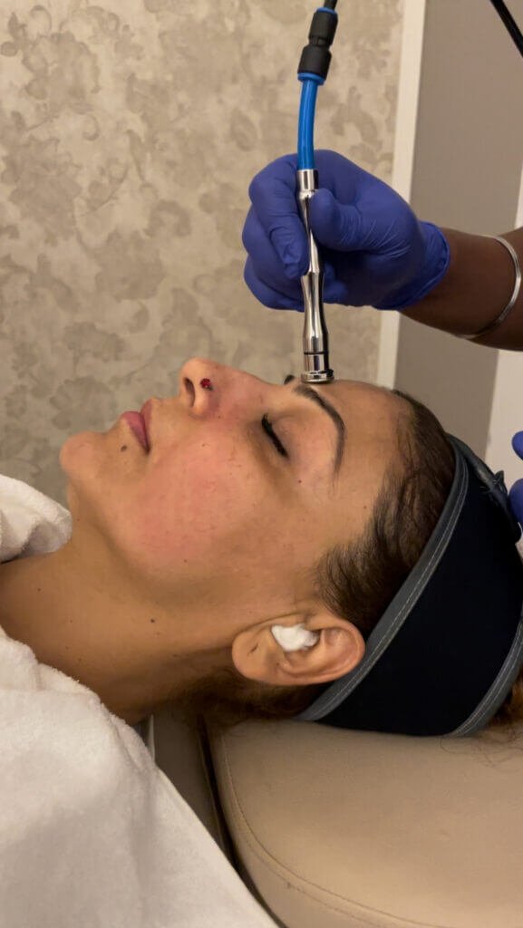 og facial