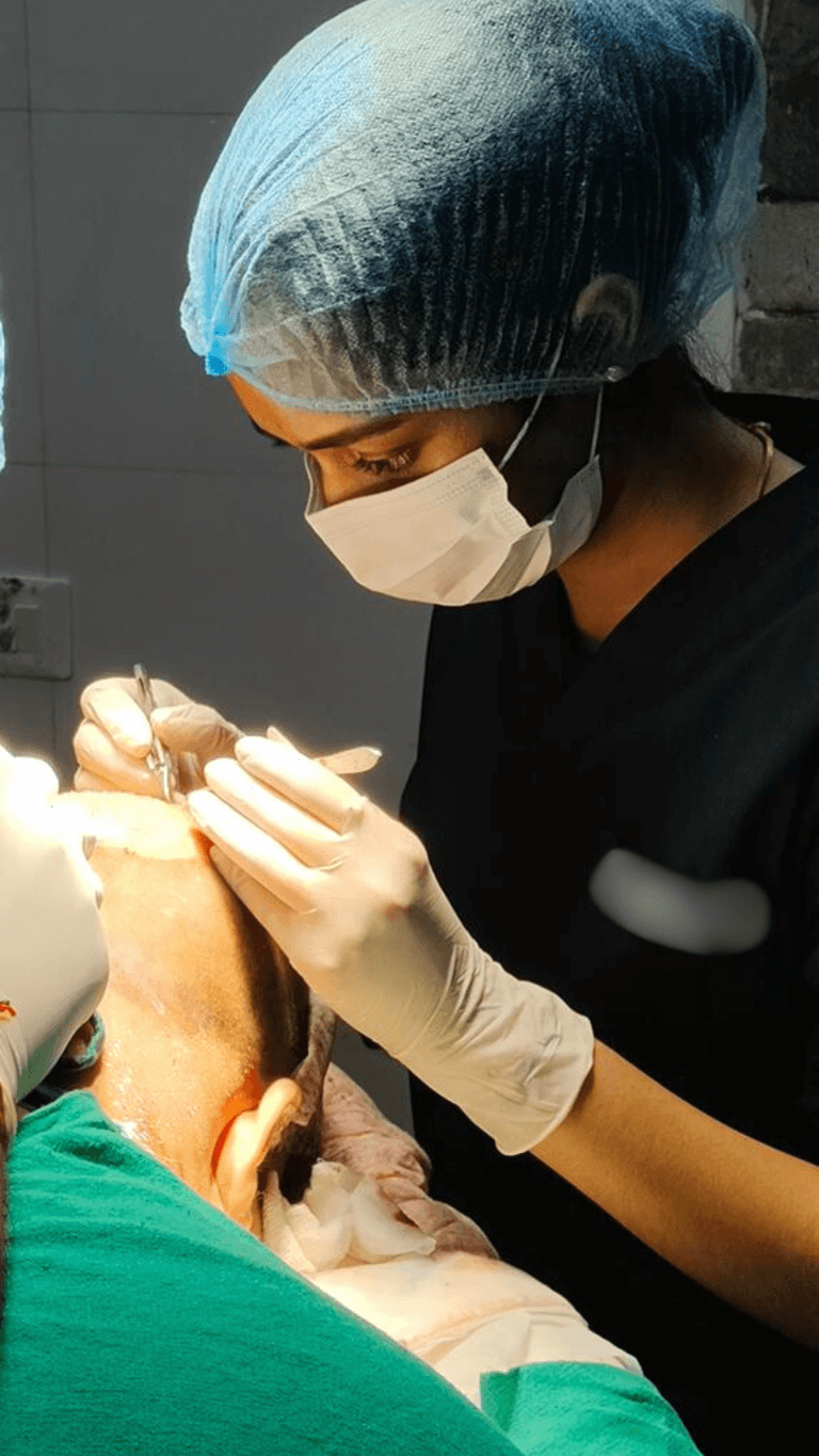 hair transplant in delhi