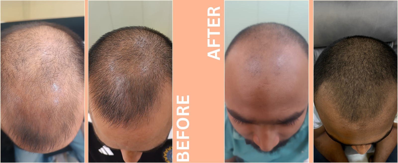 before after Hair