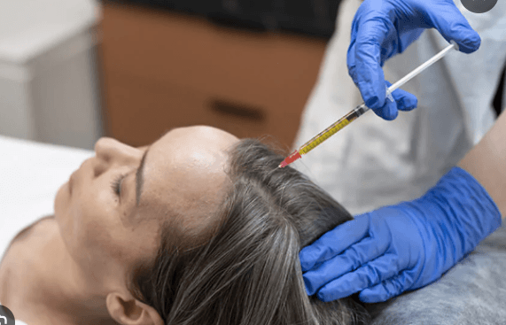 hair prp in faridabad