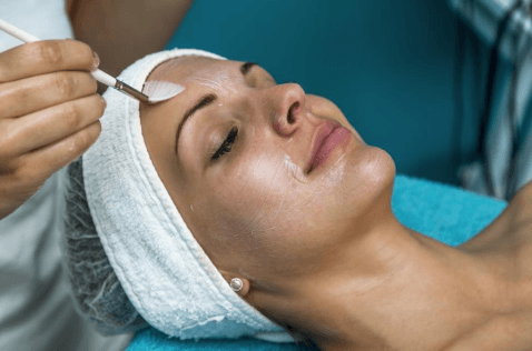 chemical peel treatment