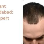 Best Hair Transplant Treatment in Faridabad: Cost, Results & Expert Guide 2026