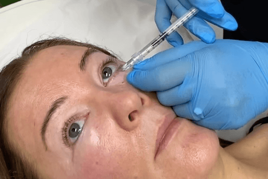 NCTF Treatment