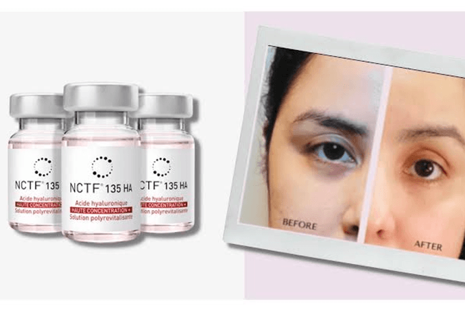 NCTF Treatment